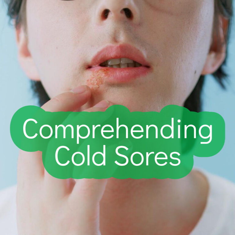 Understanding Cold Sores: Causes, Treatments, and Management