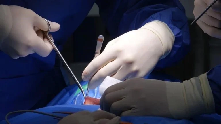 Spinal Safety: Nursing Support After Back Surgery in NYC Apartments